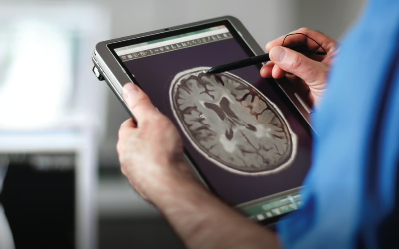 A doctor reading a brain scan